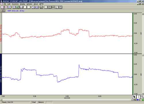 fixation calibration